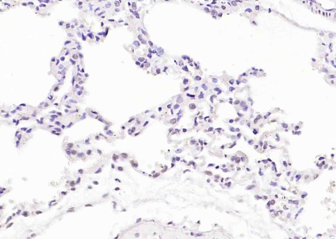 磷酸化丝氨酸/苏氨酸蛋白激酶抗体-bs-3248R