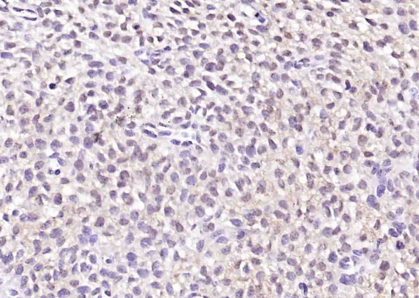 磷酸化丝氨酸/苏氨酸蛋白激酶抗体-bs-3248R