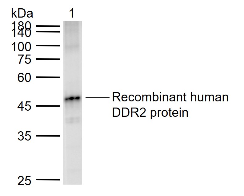 DDR2 Rabbit pAb (一抗) | Bioss