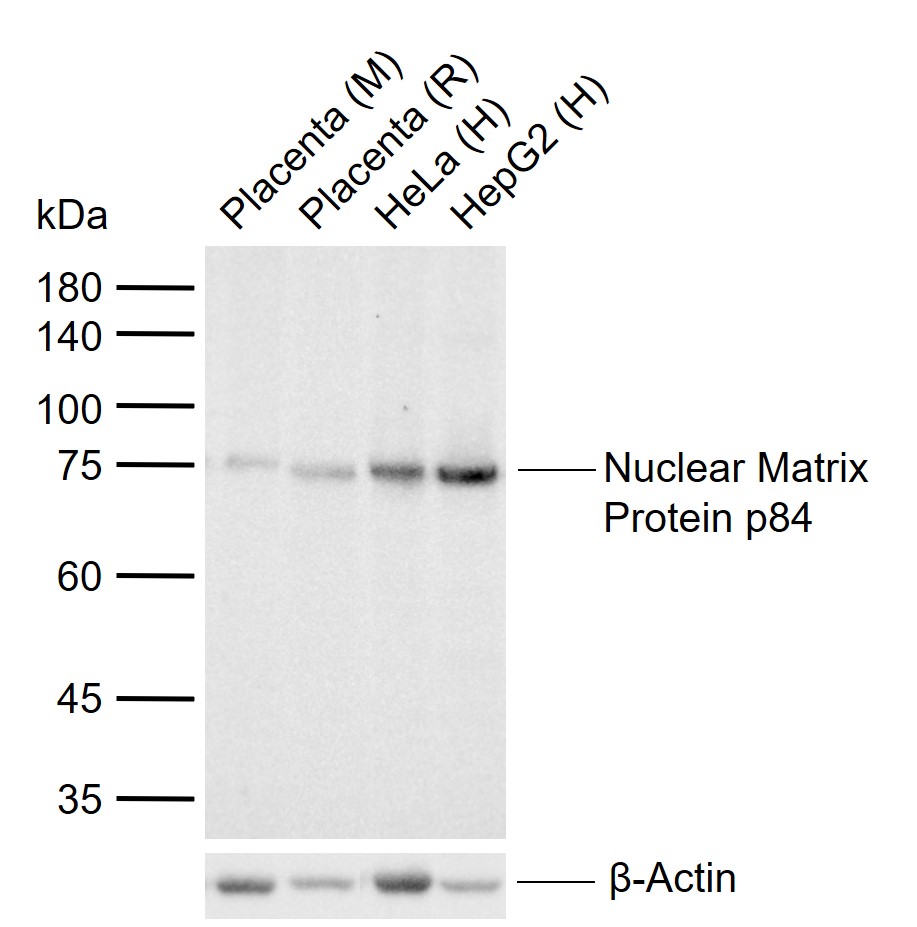 核基质p84蛋白重组兔单抗
