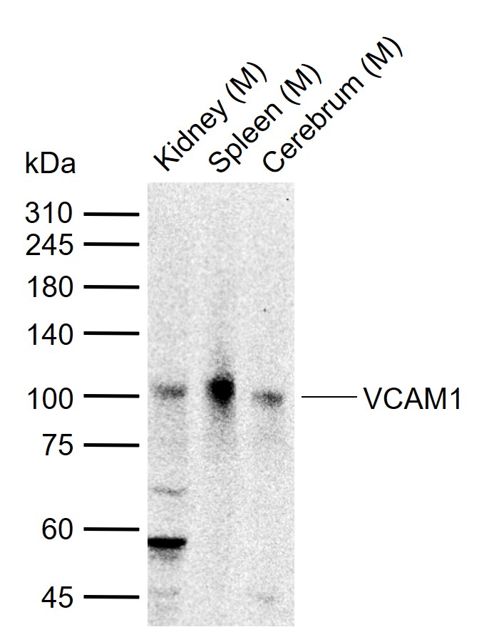 VCAM1 Rabbit pAb (一抗) - WB | Bioss