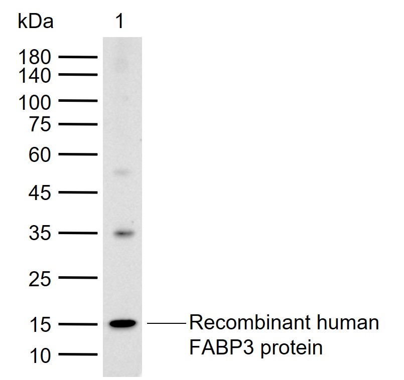 FABP3/H-FABP Rabbit pAb (一抗) | Bioss