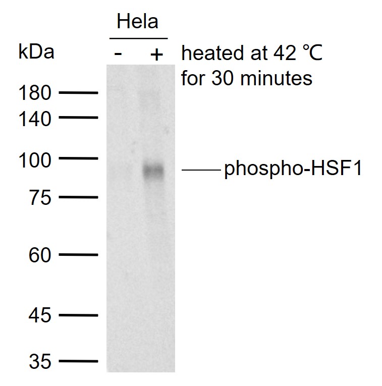 磷酸化热休克因子1重组兔单抗