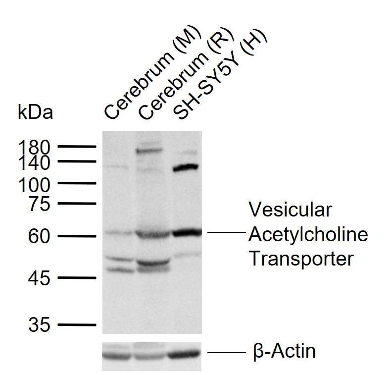 Vesicular Acetylcholine Transporter Rabbit pAb (一抗) | Bioss