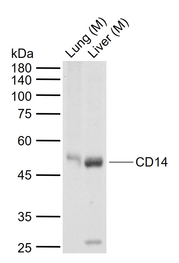 CD14 Rabbit pAb (一抗) | Bioss