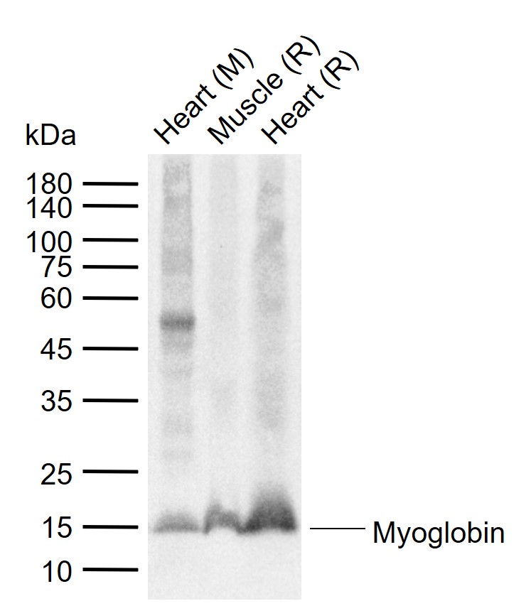 Myoglobin Mouse mAb (一抗) | Bioss