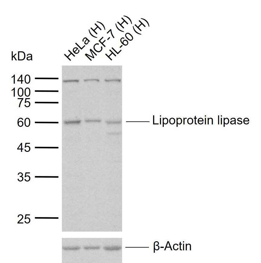 Lipoprotein lipase Rabbit pAb (一抗) - WB,IHC-P,IHC-F,IF,Flow-Cyt | Bioss