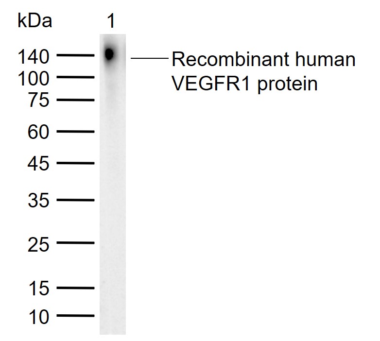 sFlt1 Rabbit pAb (一抗) | Bioss