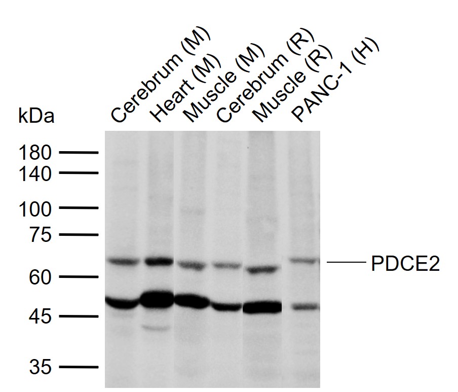 DLAT Rabbit pAb (一抗) - WB,IHC-P,IHC-F,IF | Bioss