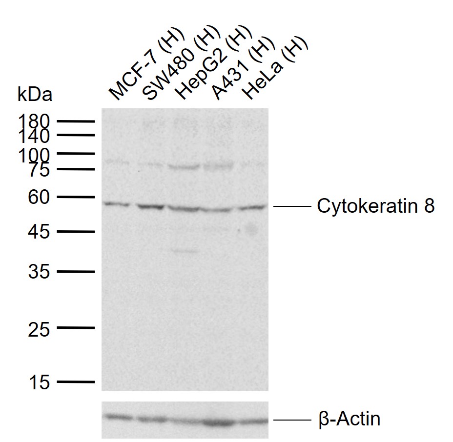 Cytokeratin 8 Rabbit pAb (一抗) | Bioss