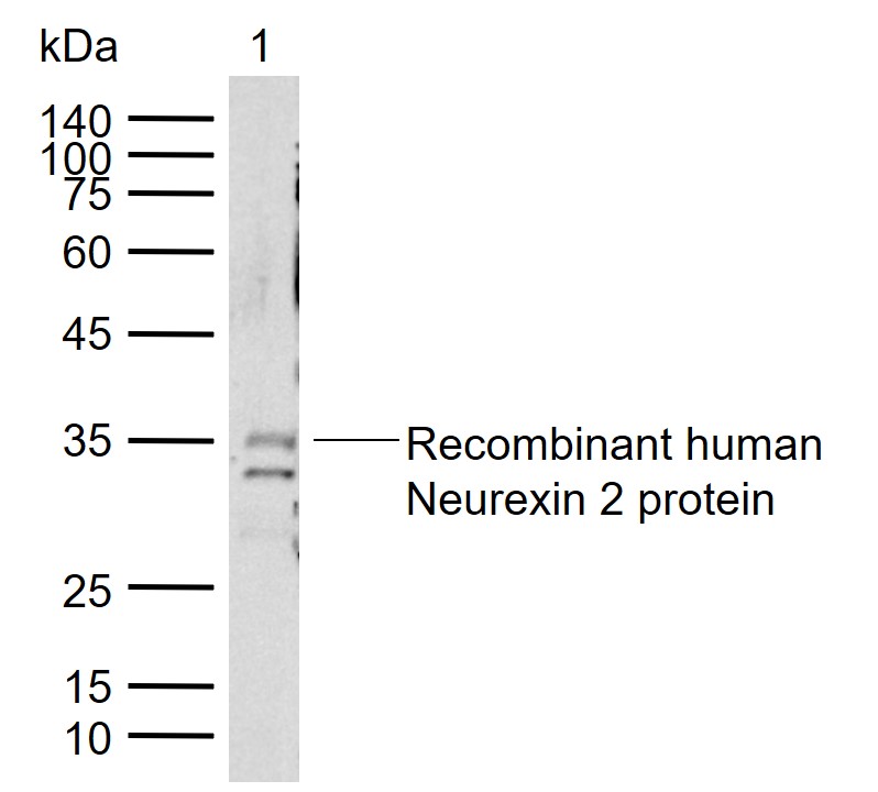 Neurexin 2 Rabbit pAb (一抗) | Bioss