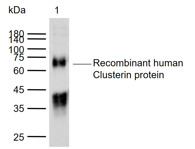 Clusterin Rabbit pAb (一抗) | Bioss