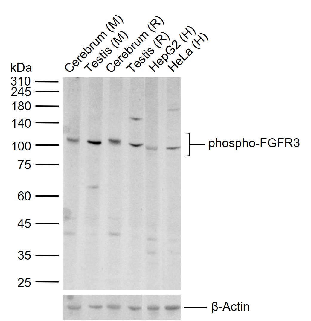 phospho- FGFR3  (Tyr724) Rabbit pAb (一抗) | Bioss