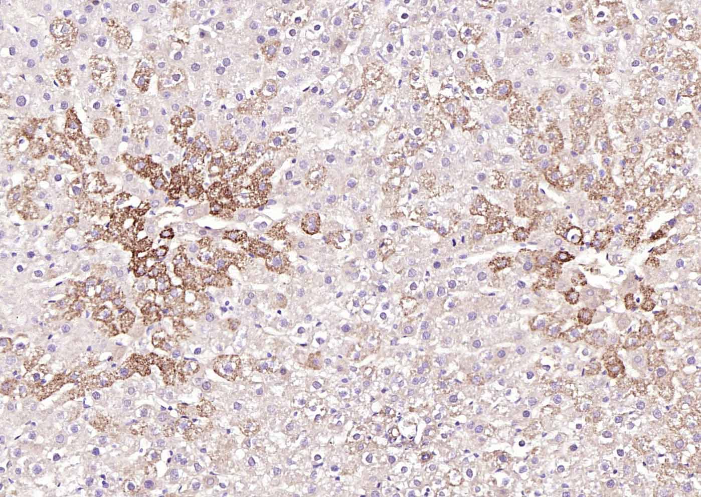 ox-LDL Mouse mAb (一抗) - IHC-P,IHC-F,IF | Bioss