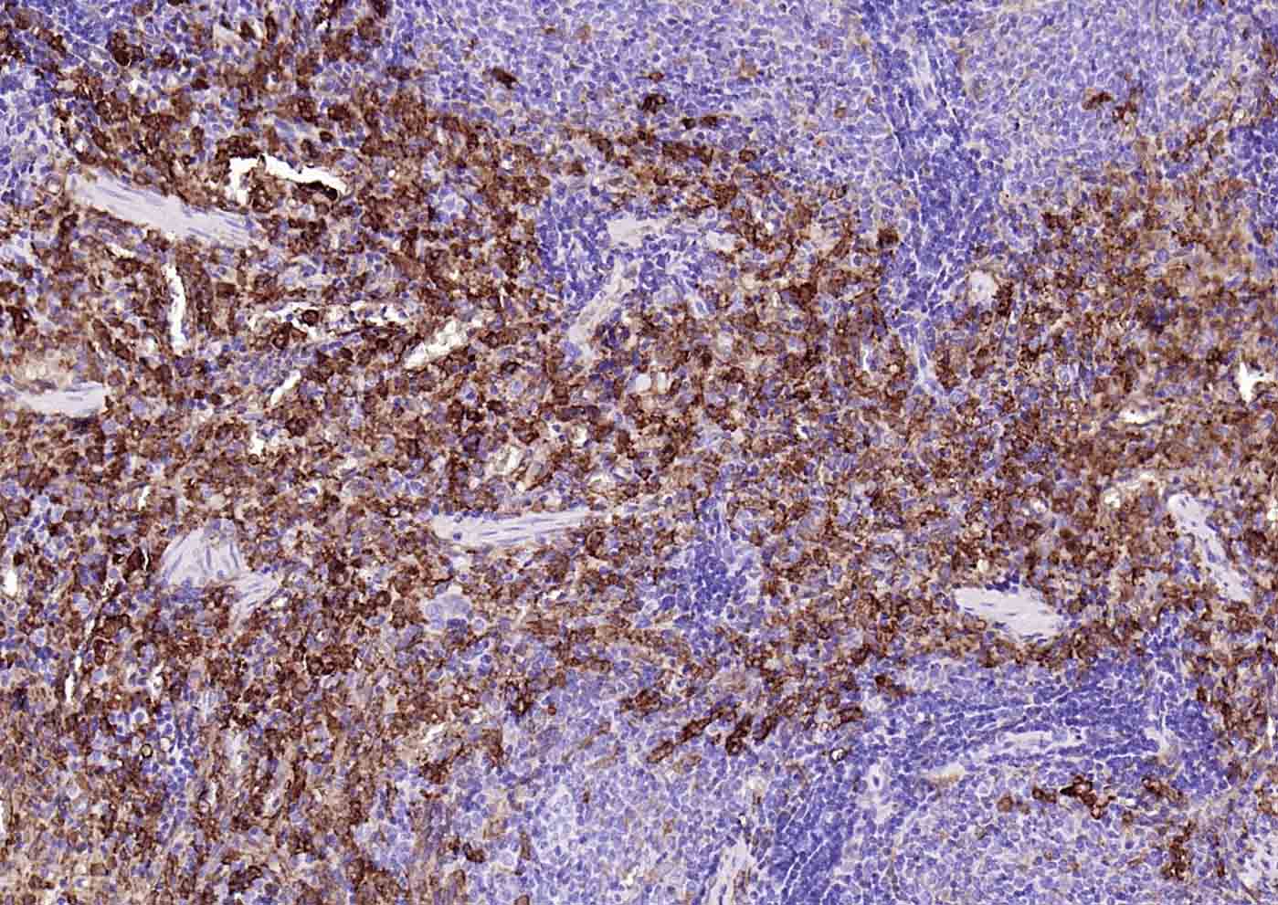 血红素氧合酶 1抗体