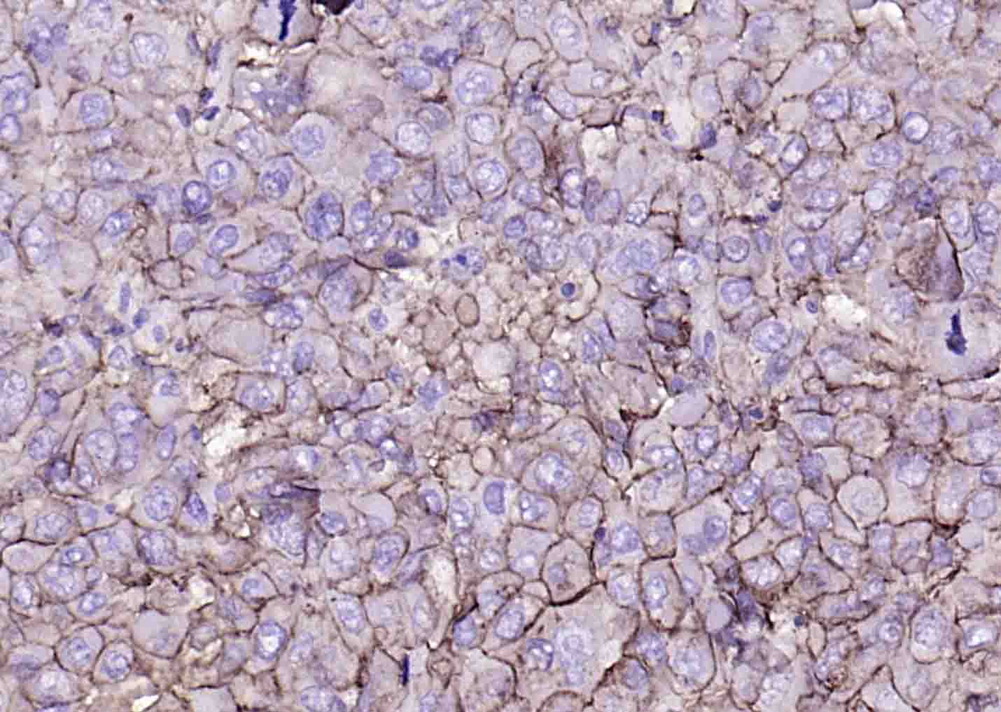 组织相容性复合体蛋白1重组兔单抗