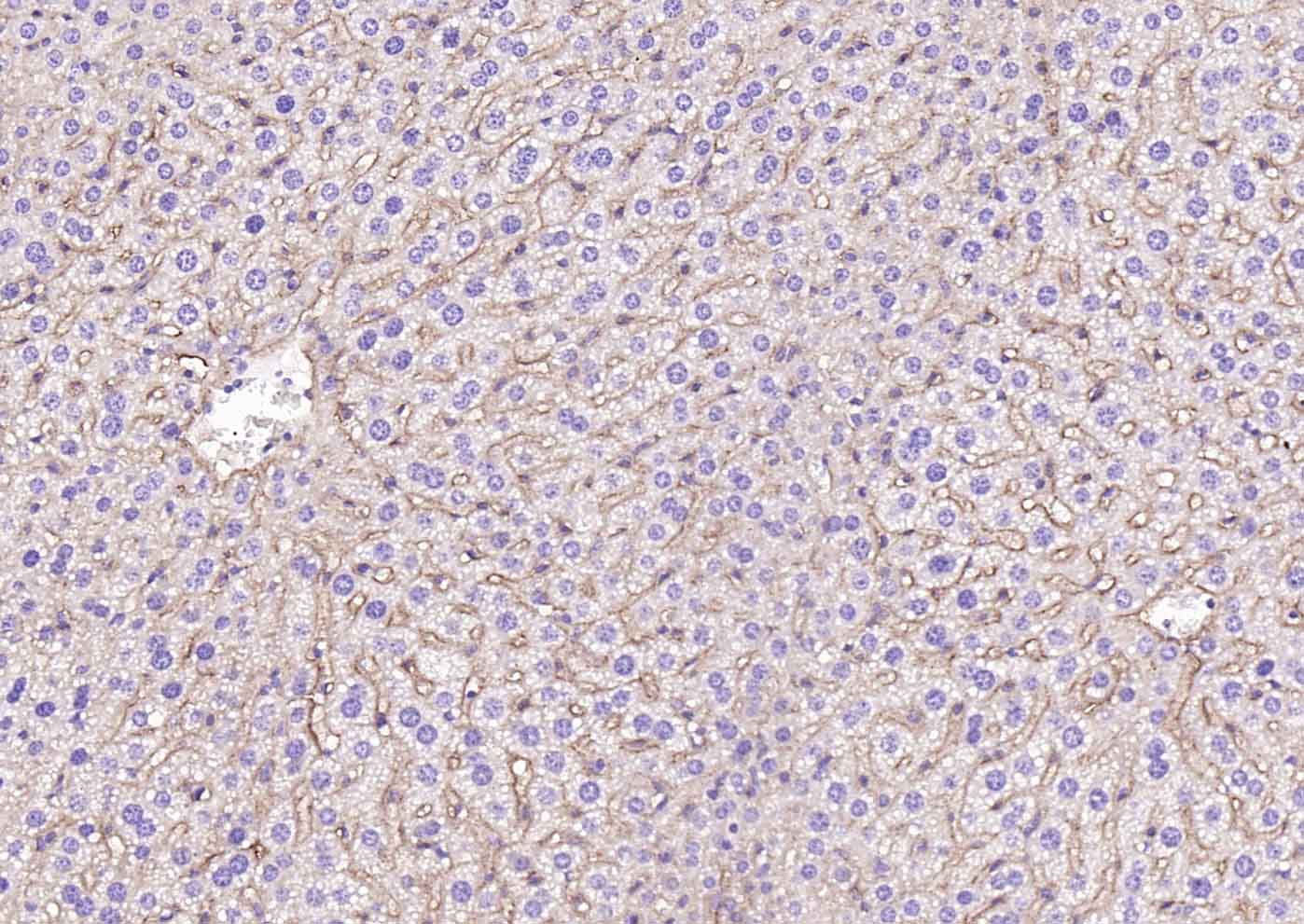 高密度脂蛋白受体/清道夫受体重组兔单抗