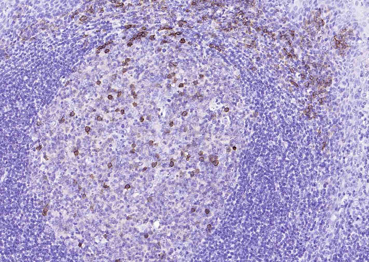 CD38单克隆抗体-bsm-34151M