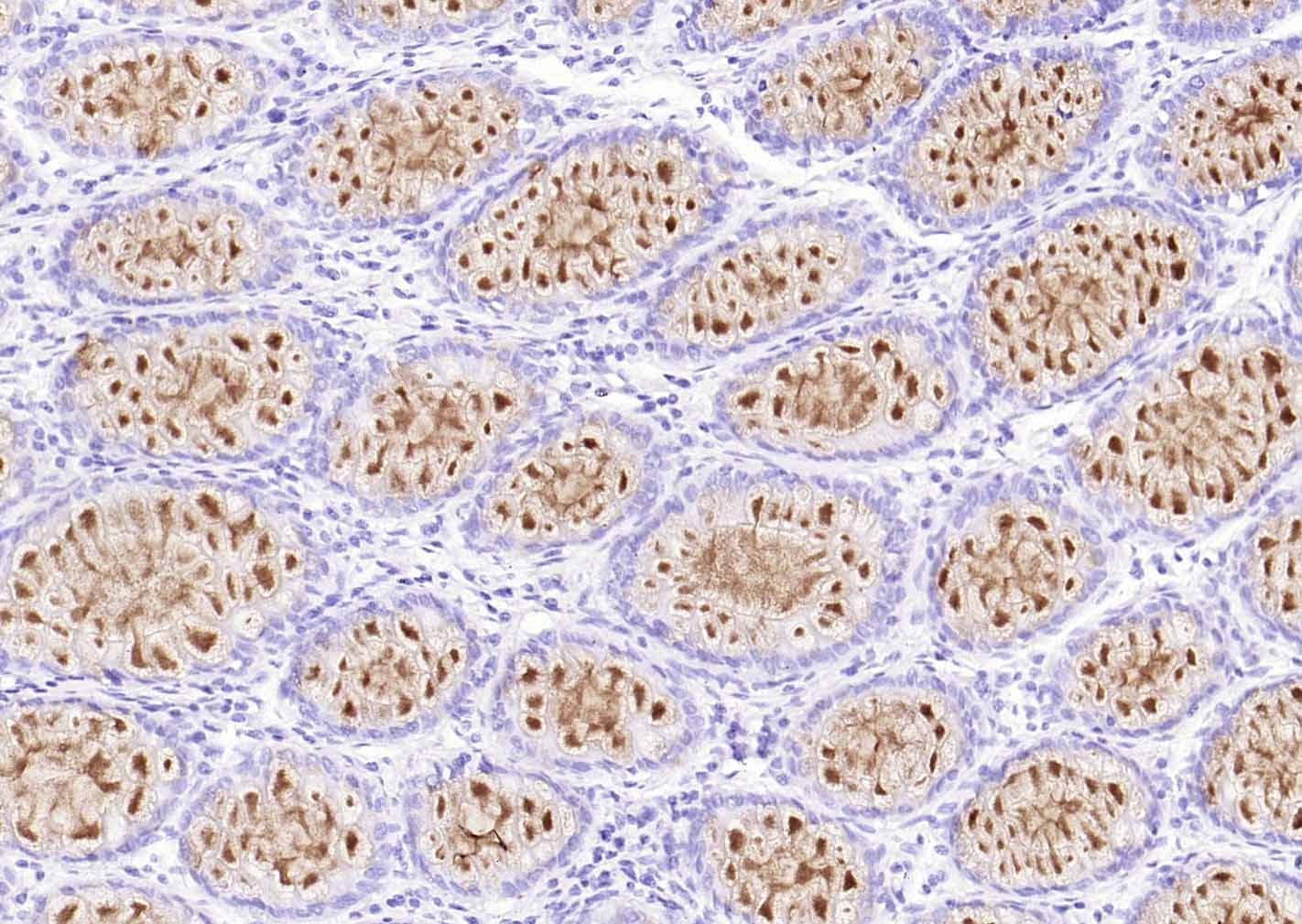 粘蛋白-2/上皮膜抗原2重组兔单抗