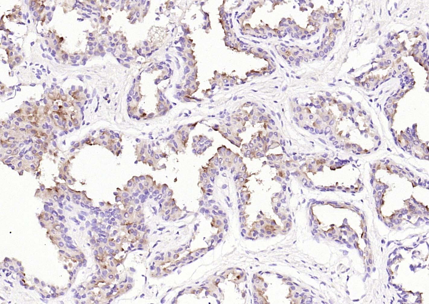 前列腺特异膜抗原重组兔单克隆抗体