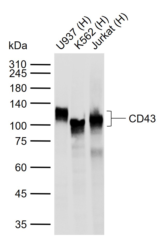 CD43重组兔单抗