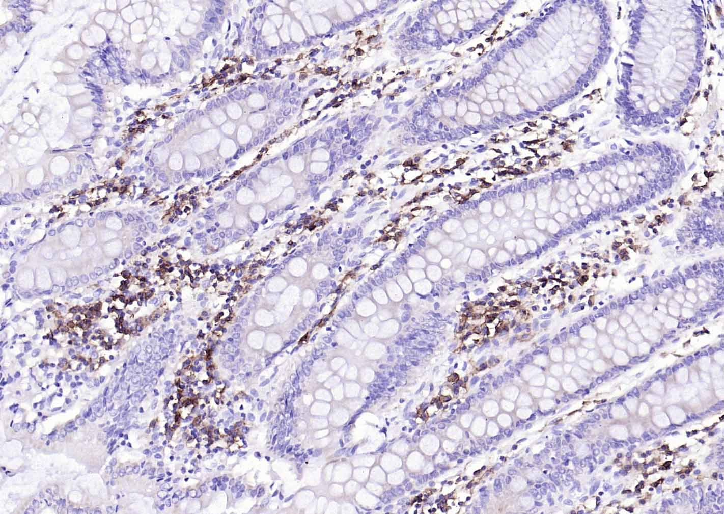 CD38单克隆抗体-bsm-34151M