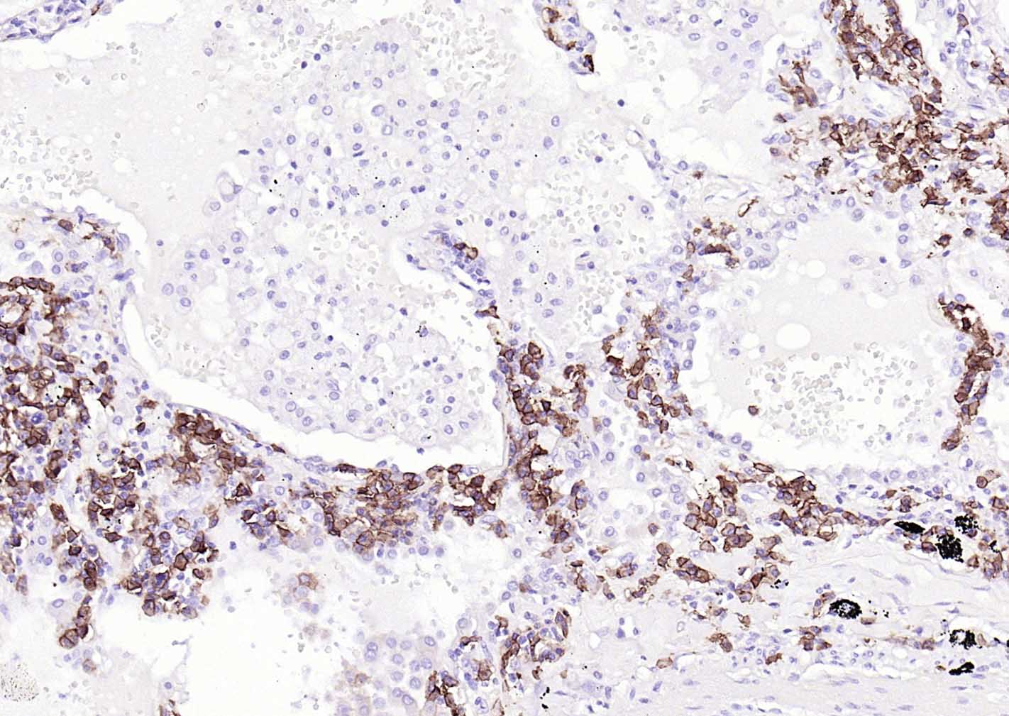 CD38 Mouse mAb (一抗) - IHC-P,IHC-F,IF | Bioss