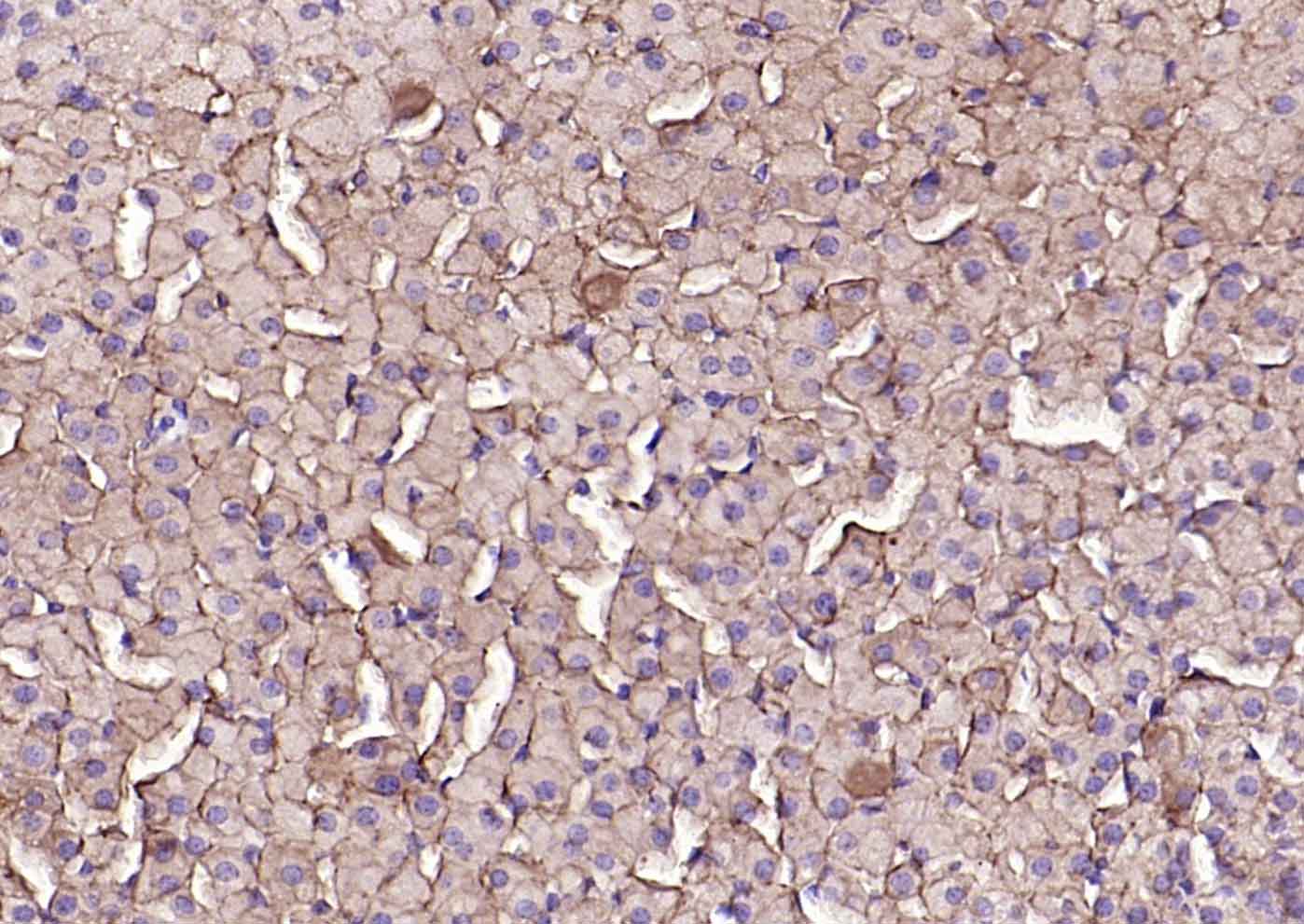 高密度脂蛋白受体/清道夫受体重组兔单抗