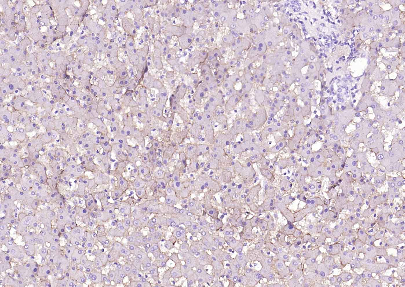 高密度脂蛋白受体/清道夫受体重组兔单抗