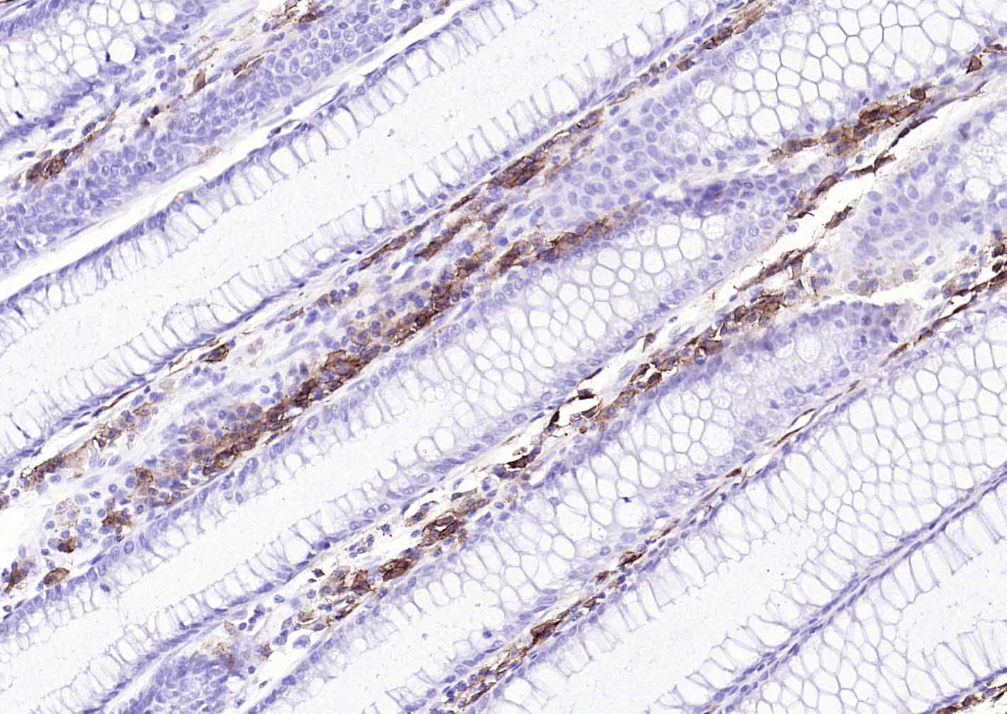 CD38单克隆抗体-bsm-34151M