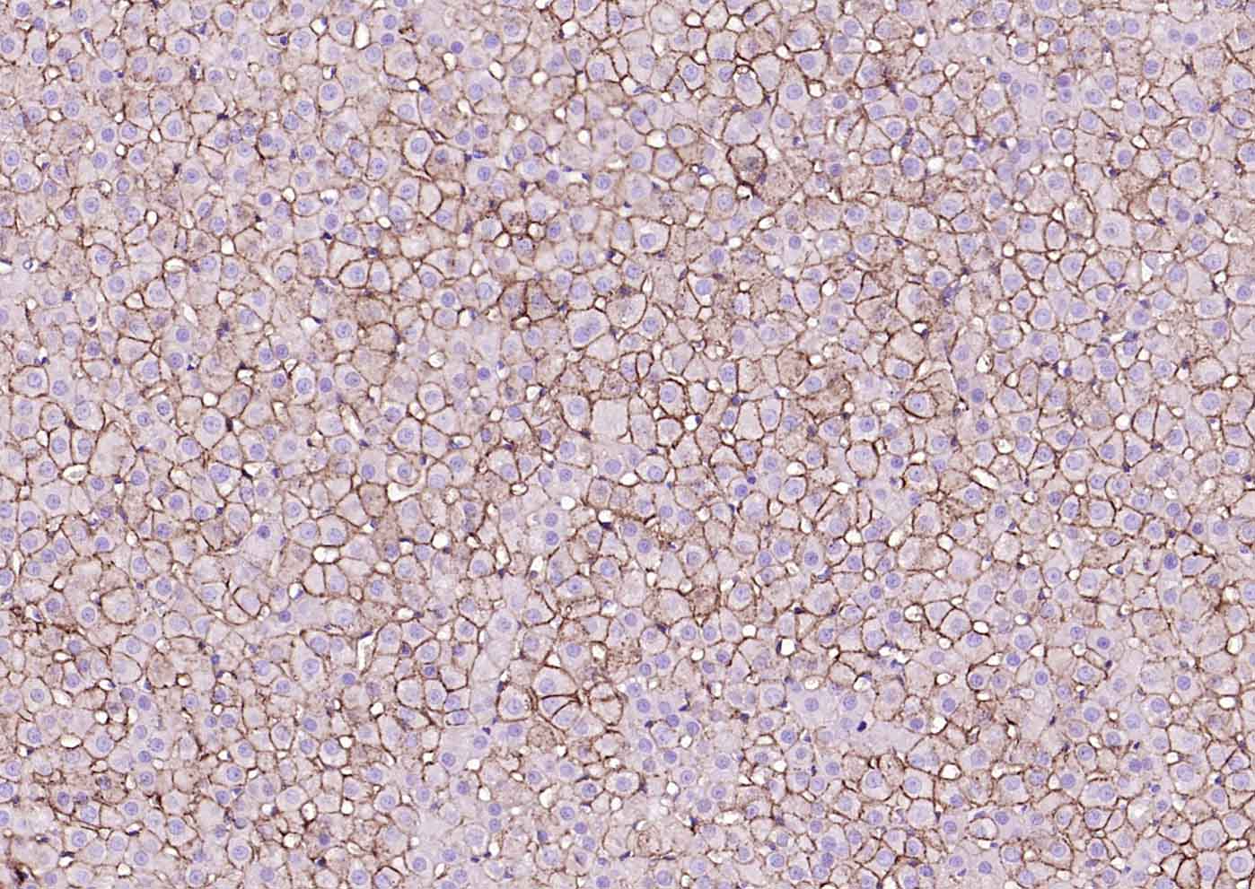 高密度脂蛋白受体/清道夫受体重组兔单抗