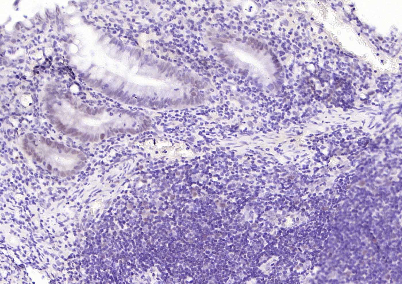 错配修复蛋白1单克隆抗体-bsm-34145M