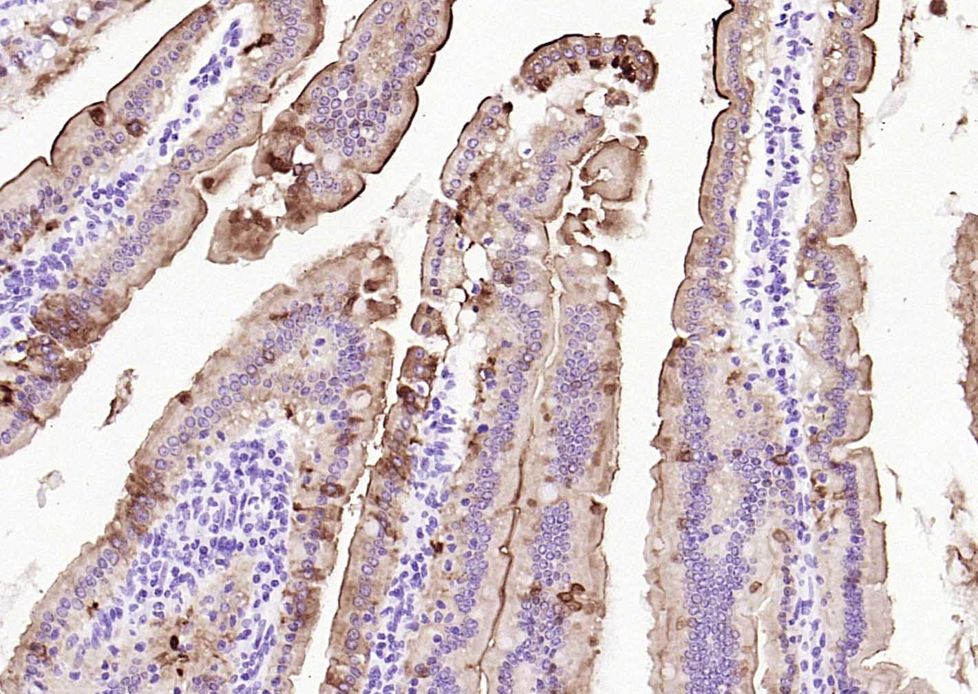 绒毛蛋白重组兔单抗
