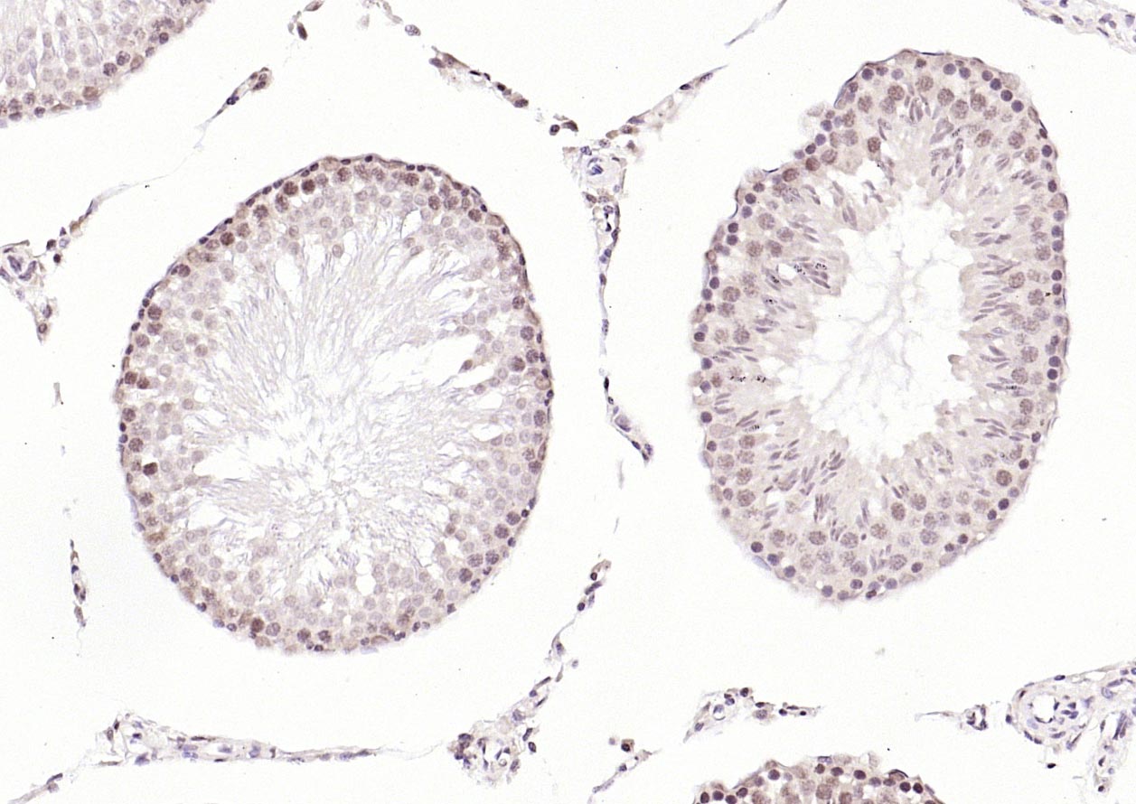 PMS2 Mouse mAb (一抗) | Bioss