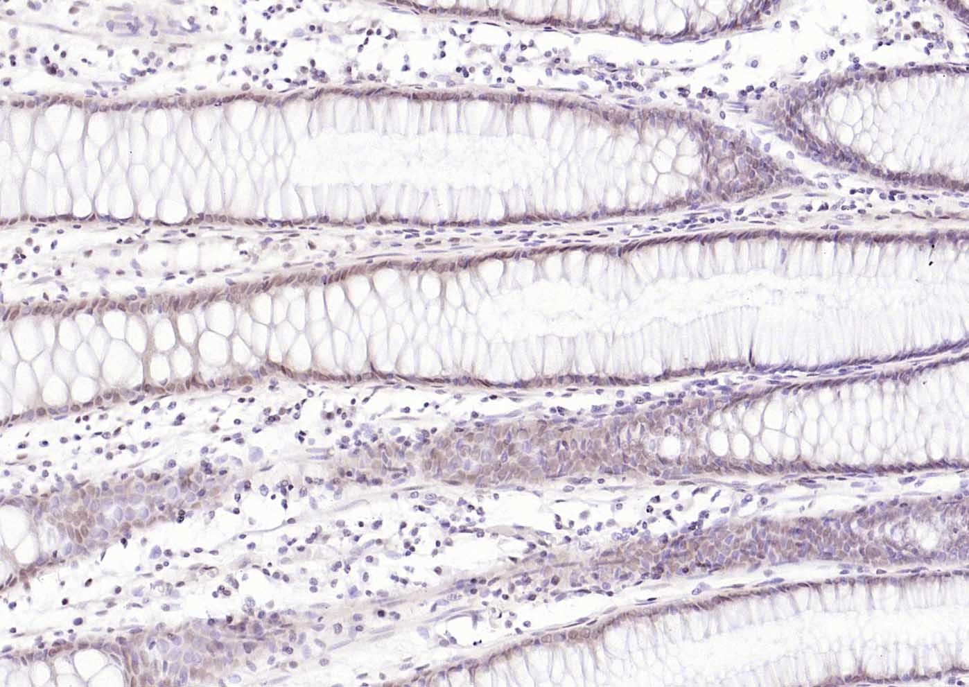 错配修复蛋白1单克隆抗体-bsm-34145M