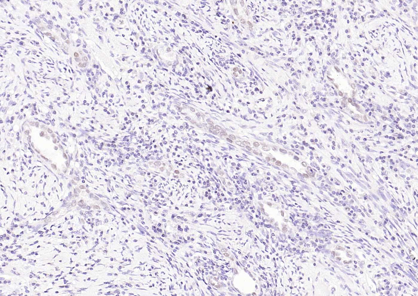 MLH1 Mouse mAb (一抗) - IHC-P,IHC-F,IF | Bioss