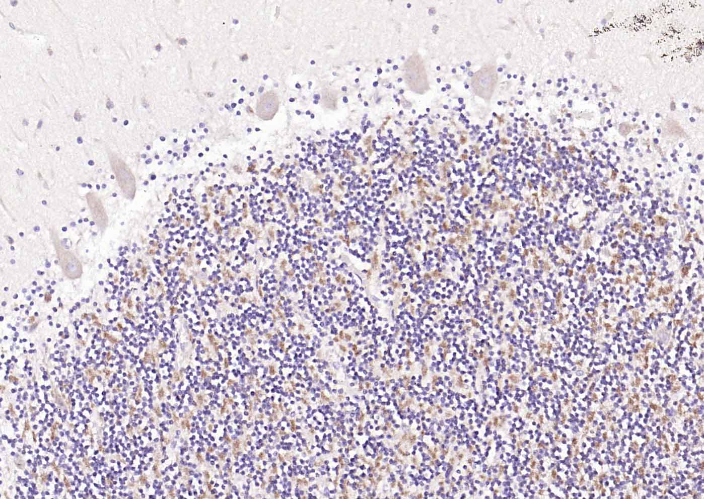 神经细胞胞浆蛋白9.5/蛋白基因产物9.5抗体-bs-3806R