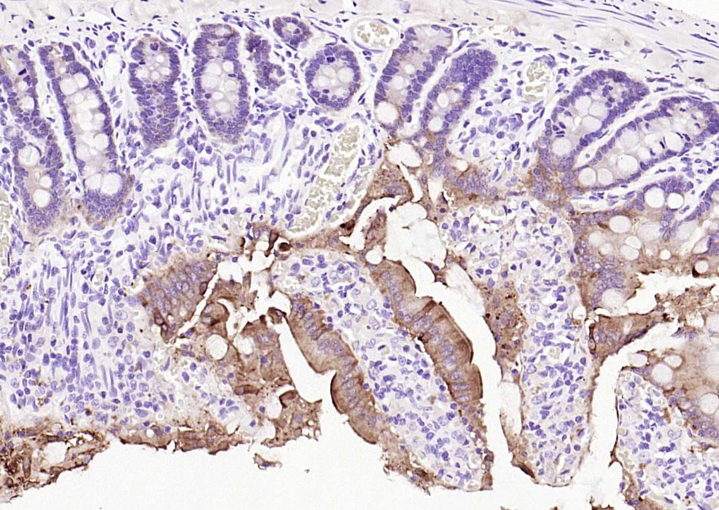 绒毛蛋白重组兔单抗