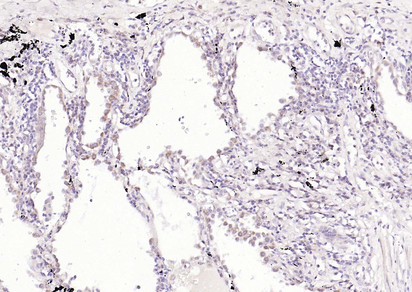 神经细胞胞浆蛋白9.5/蛋白基因产物9.5抗体-bs-3806R