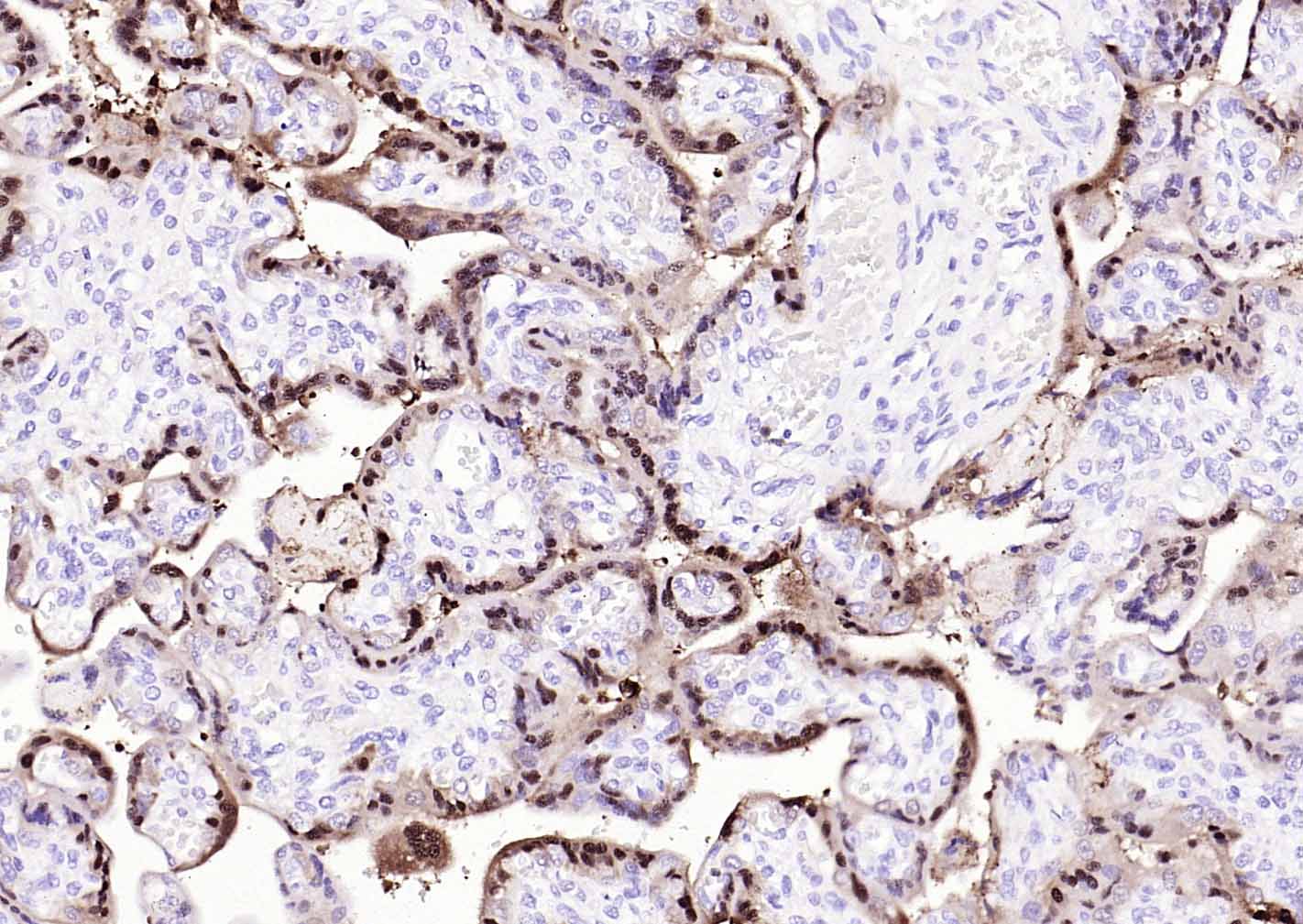 S100钙结合蛋白P重组兔单抗