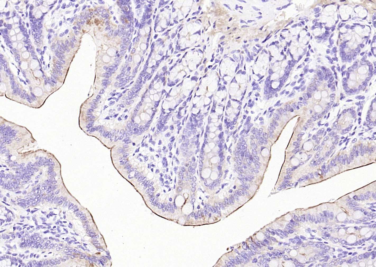 绒毛蛋白重组兔单抗