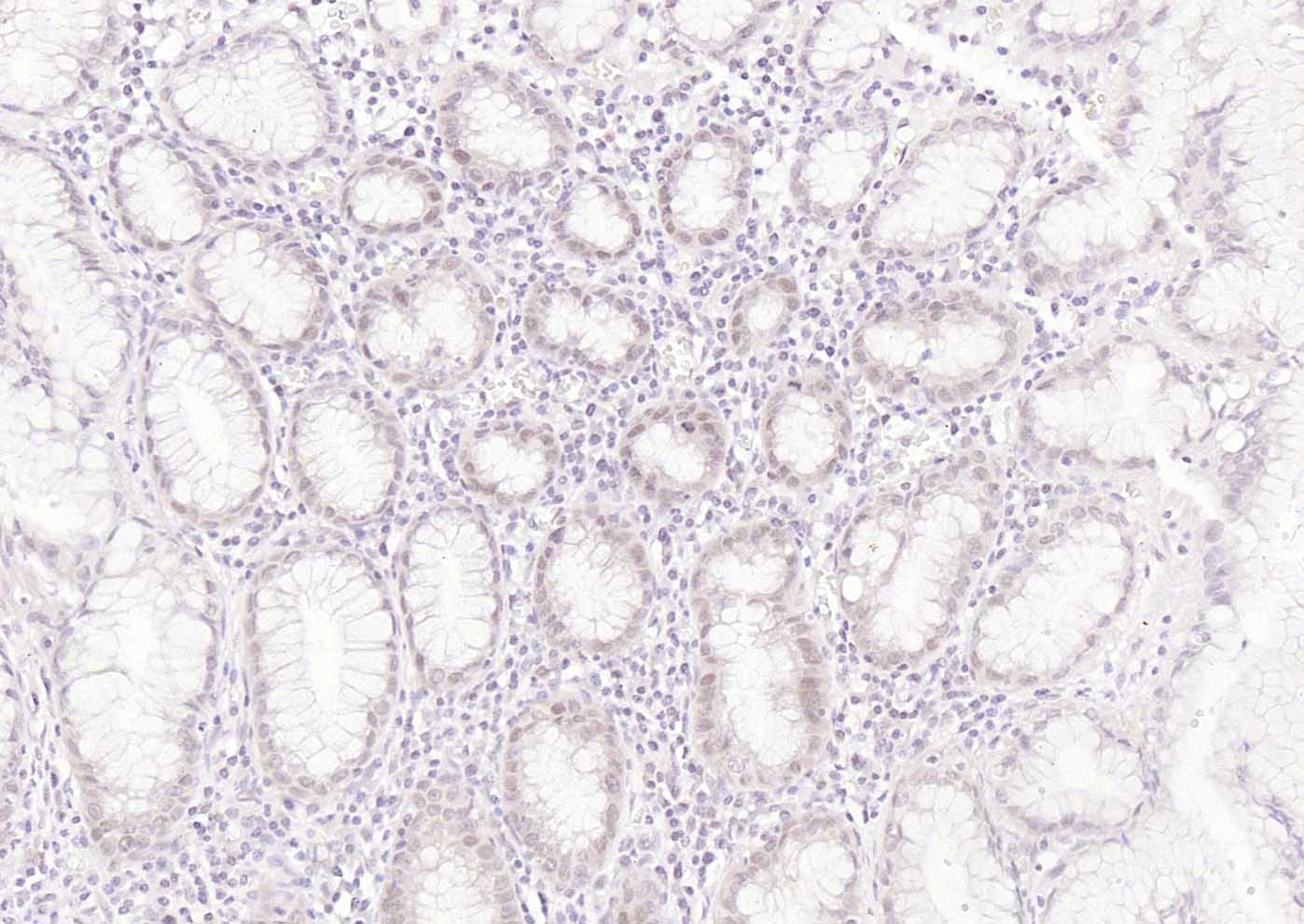 错配修复蛋白1单克隆抗体-bsm-34145M