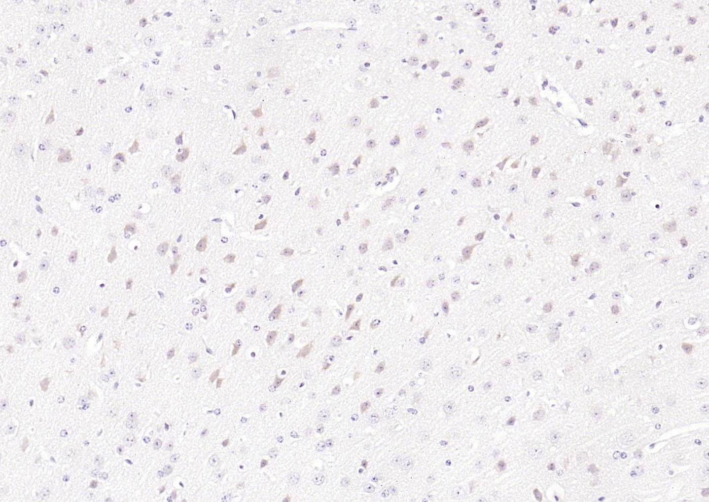 神经细胞胞浆蛋白9.5/蛋白基因产物9.5抗体-bs-3806R