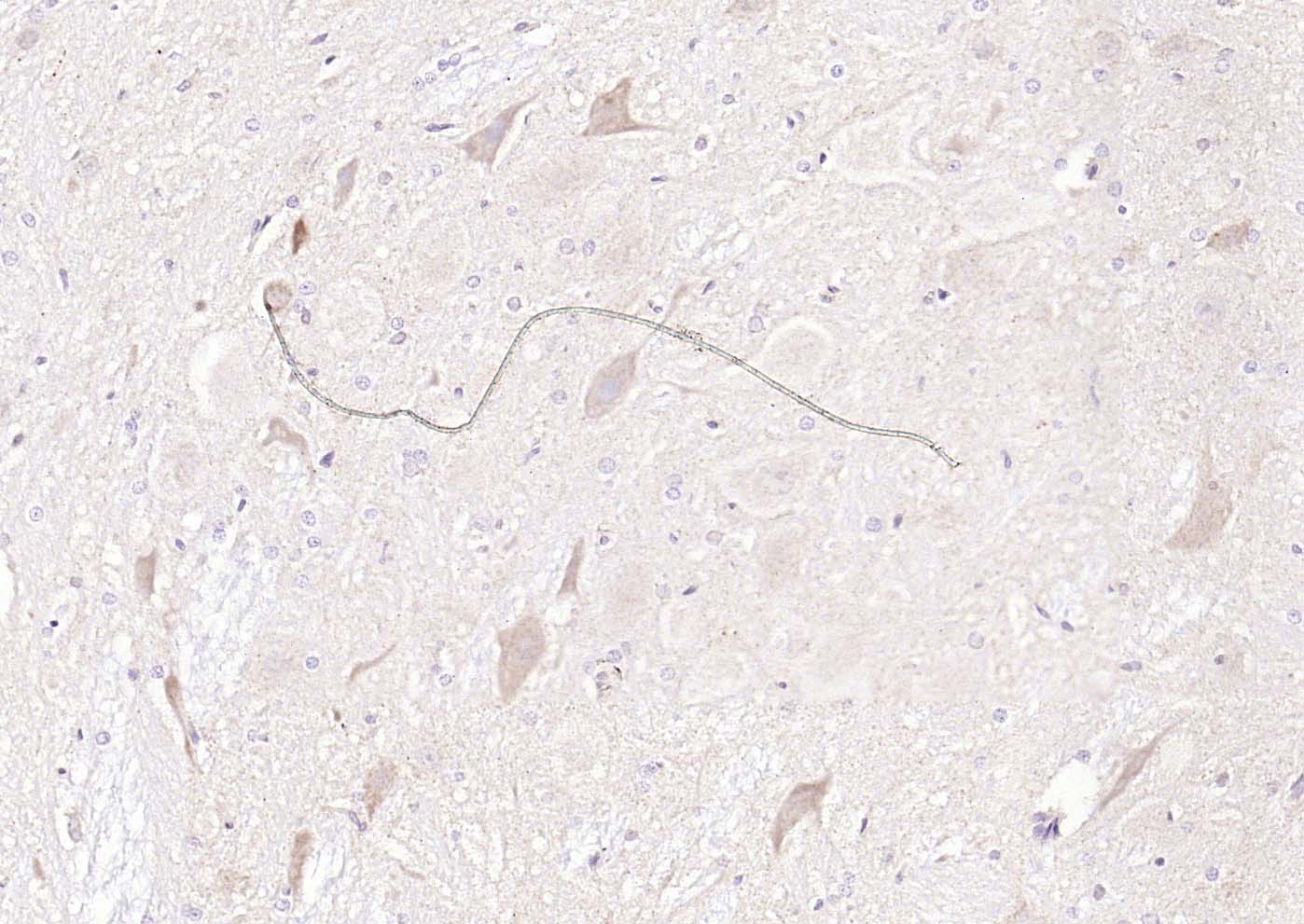 神经细胞胞浆蛋白9.5/蛋白基因产物9.5抗体-bs-3806R