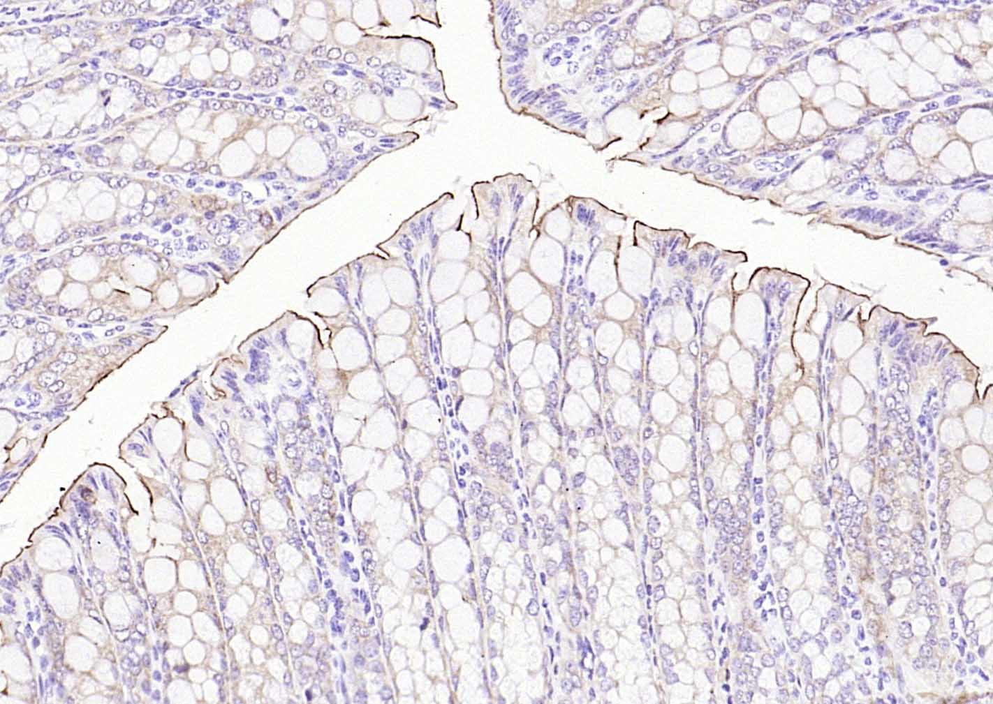 绒毛蛋白重组兔单抗