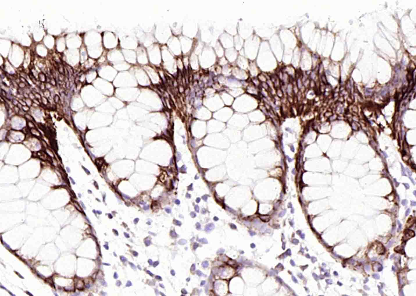 细胞角蛋白20抗体-bsm-34154M