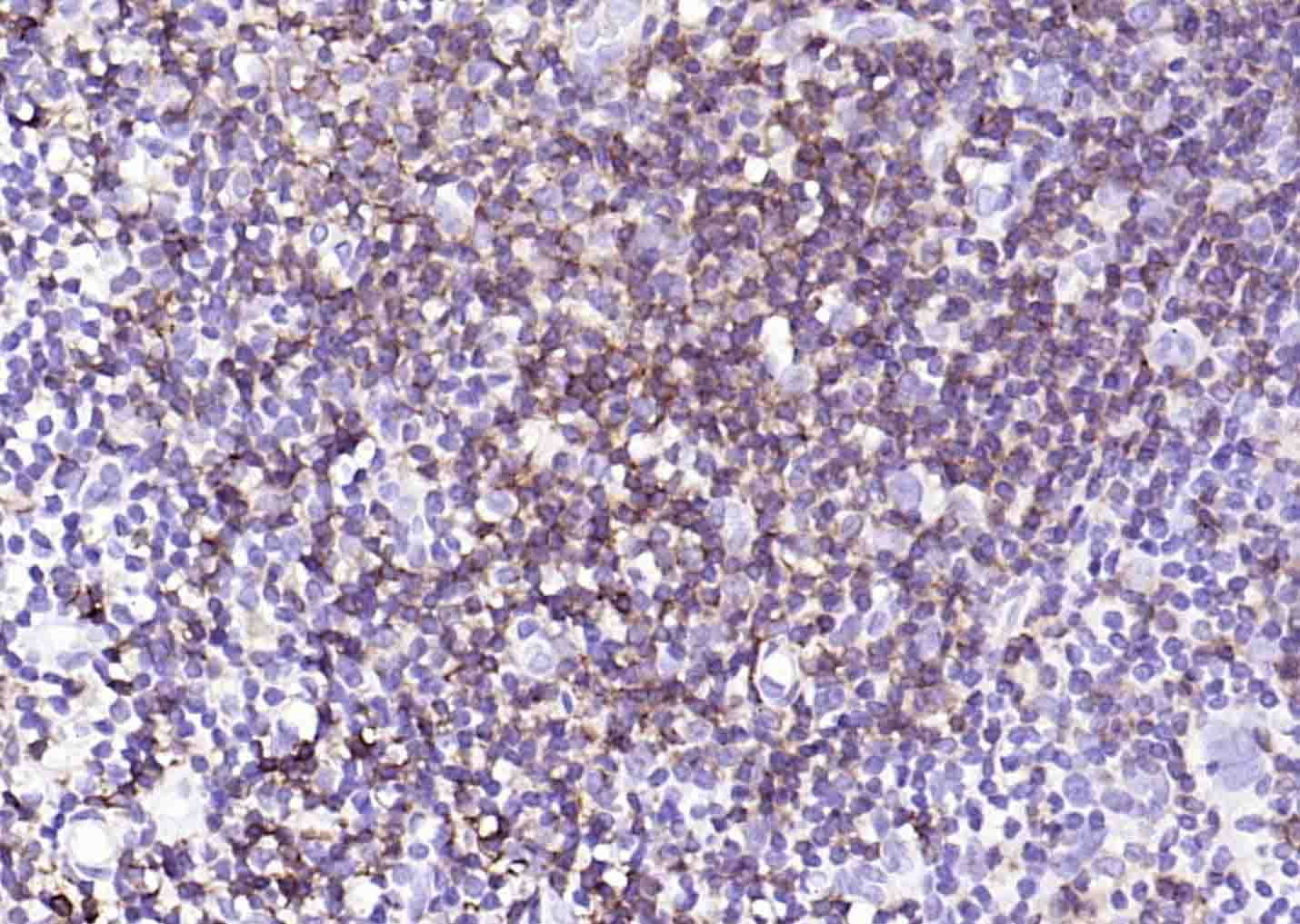 Human CD43 Mouse mAb (一抗) - IHC-P,IHC-F,IF,ICC/IF,ELISA | Bioss