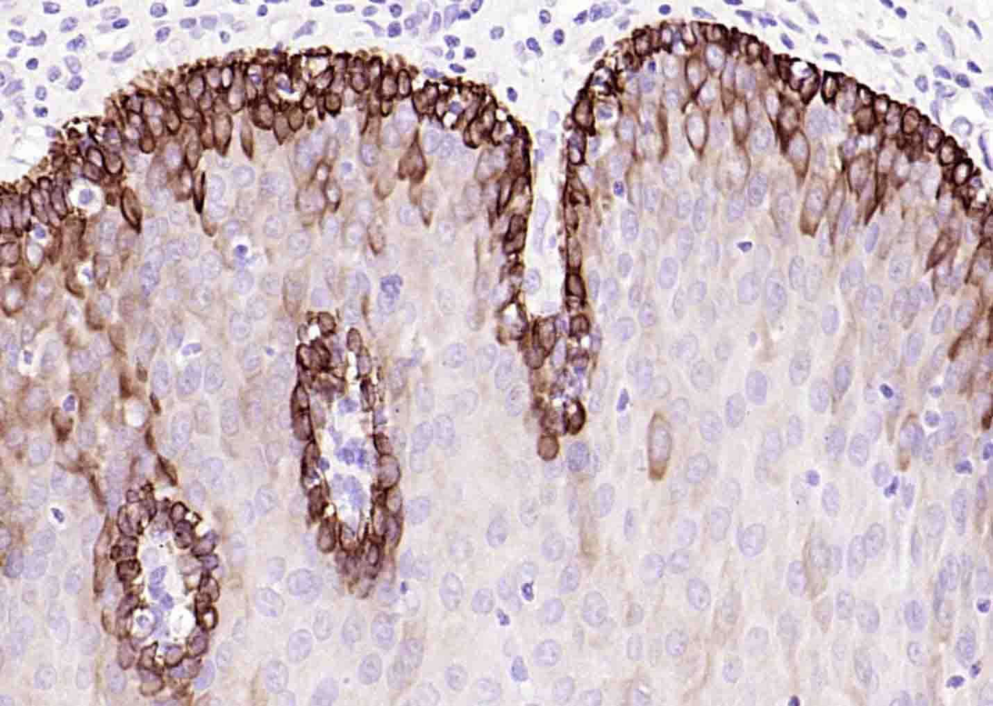 细胞角蛋白14t单克隆抗体-bsm-34152M