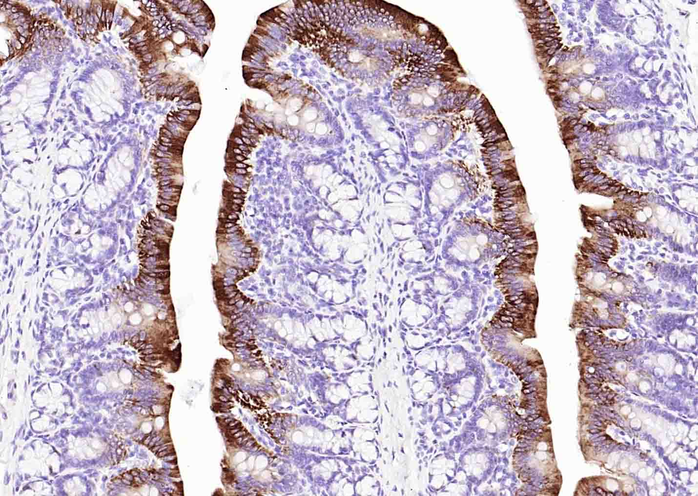 Cytokeratin 20 Mouse mAb (一抗) - IHC-P,IHC-F,IF | Bioss