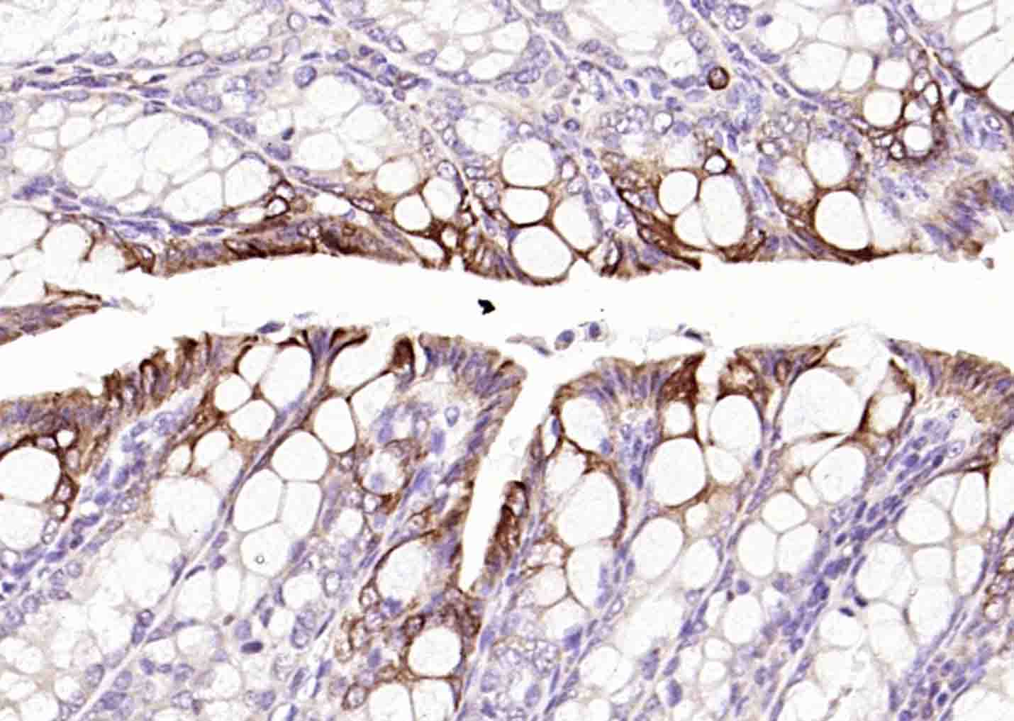细胞角蛋白20抗体-bsm-34154M